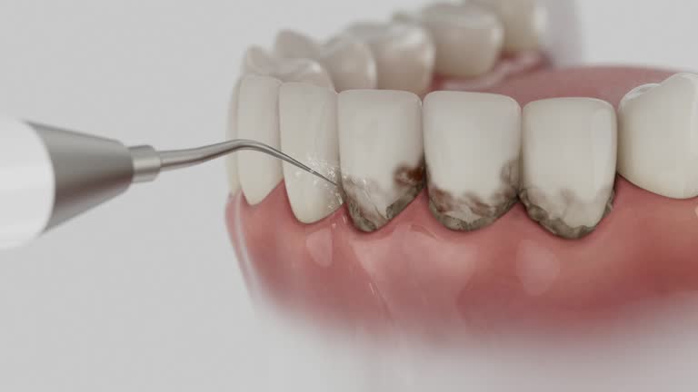 Reliable Dental contractor in Kensington, CA by Smile Center Dentistry